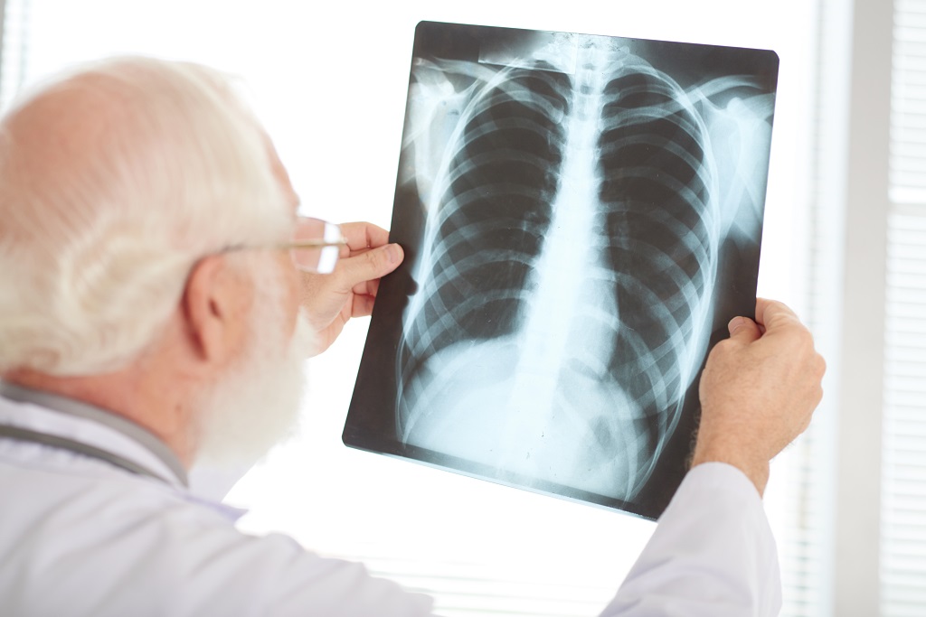 Pneumonia: conheça os riscos dessa doença em idosos